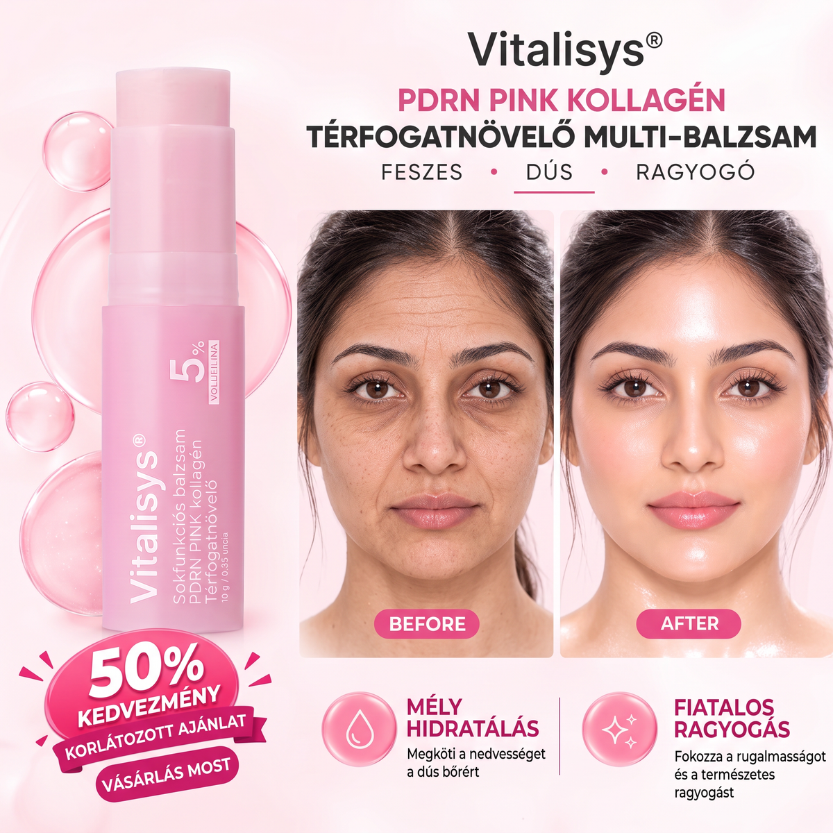🔥🔥 Vitalisys® Koreai PDRN rózsaszín kollagénes dúsító balzsam