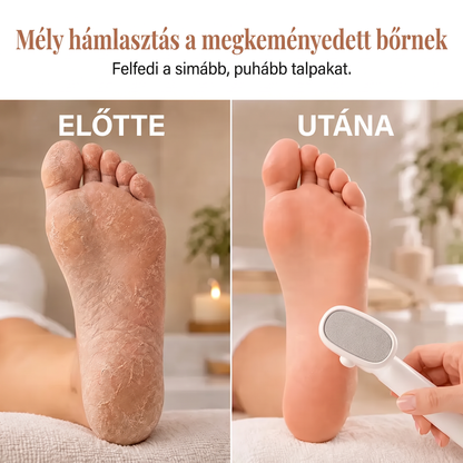🔥🔥LEFUN® Precíziós lábreszelő 🌟 eltávolítja az érdes és megkeményedett bőrt, segít simává tenni a sarkat, és lehetővé teszi, hogy kényelmesen, otthon végezd a lábápolást