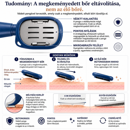 🌈🌈LEFUN® Precíziós lábreszelő 🌟 eltávolítja az érdes és megkeményedett bőrt, segít simává tenni a sarkat, és lehetővé teszi, hogy kényelmesen, otthon végezd a lábápolást